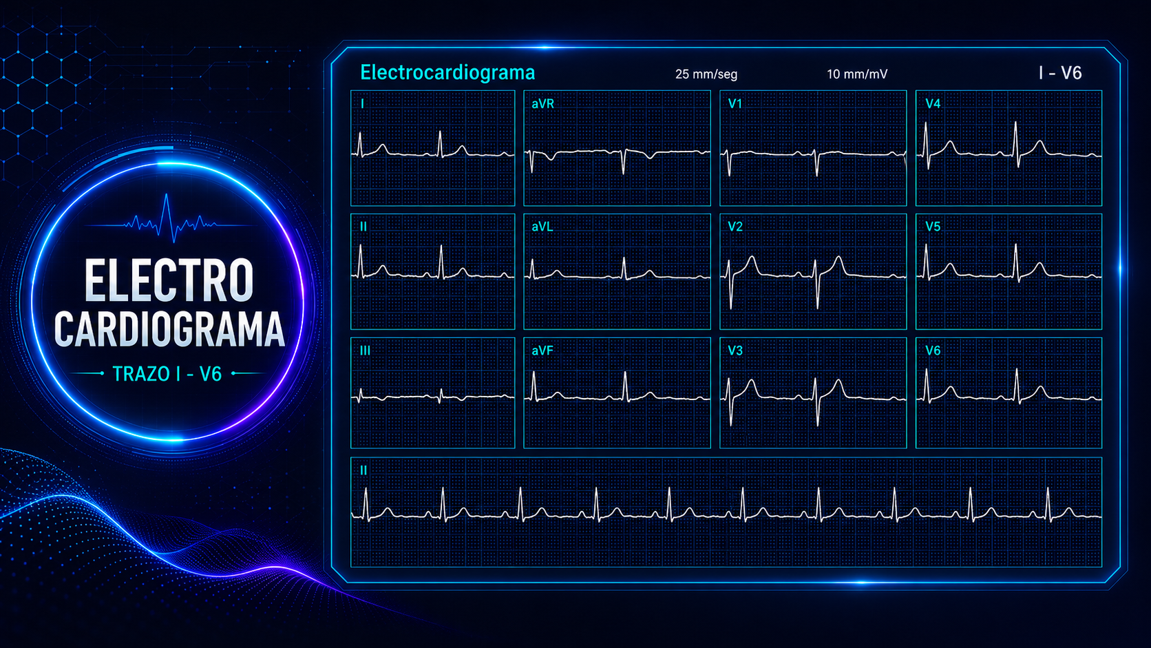 Resultados DR.ECG, vista 3
